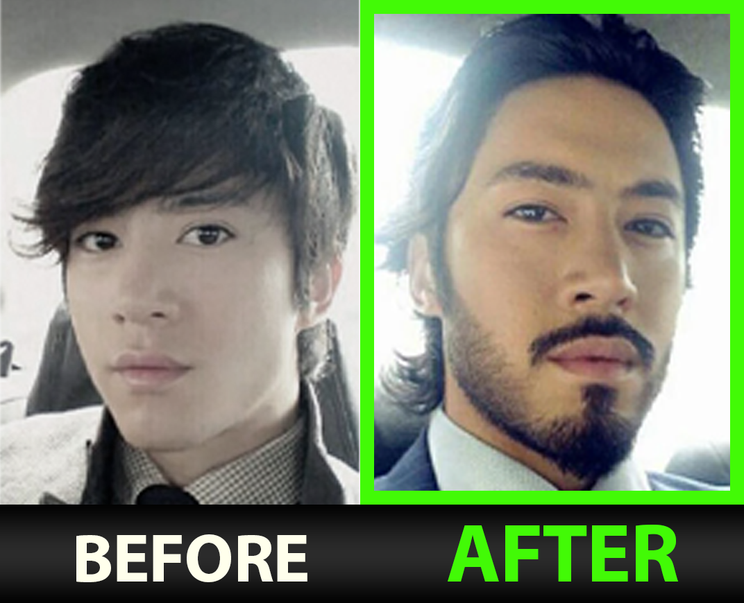 Before and after — Kai L.