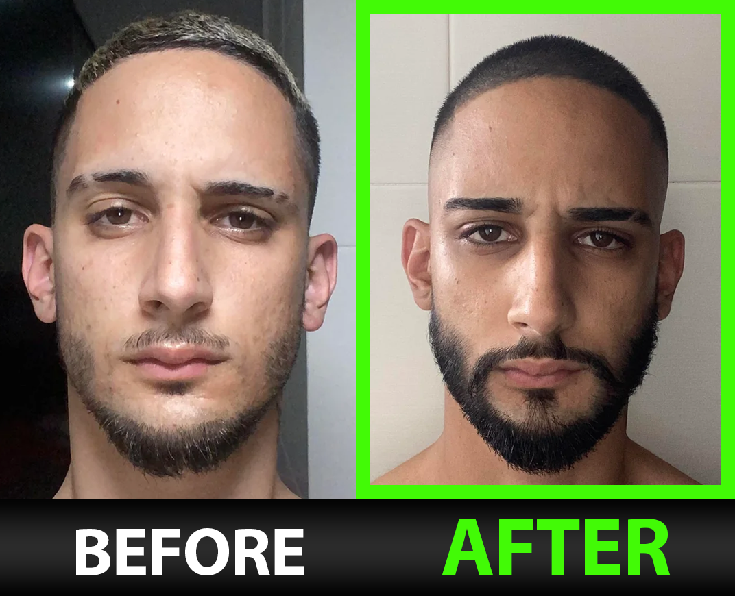 Before and after — Parker P.