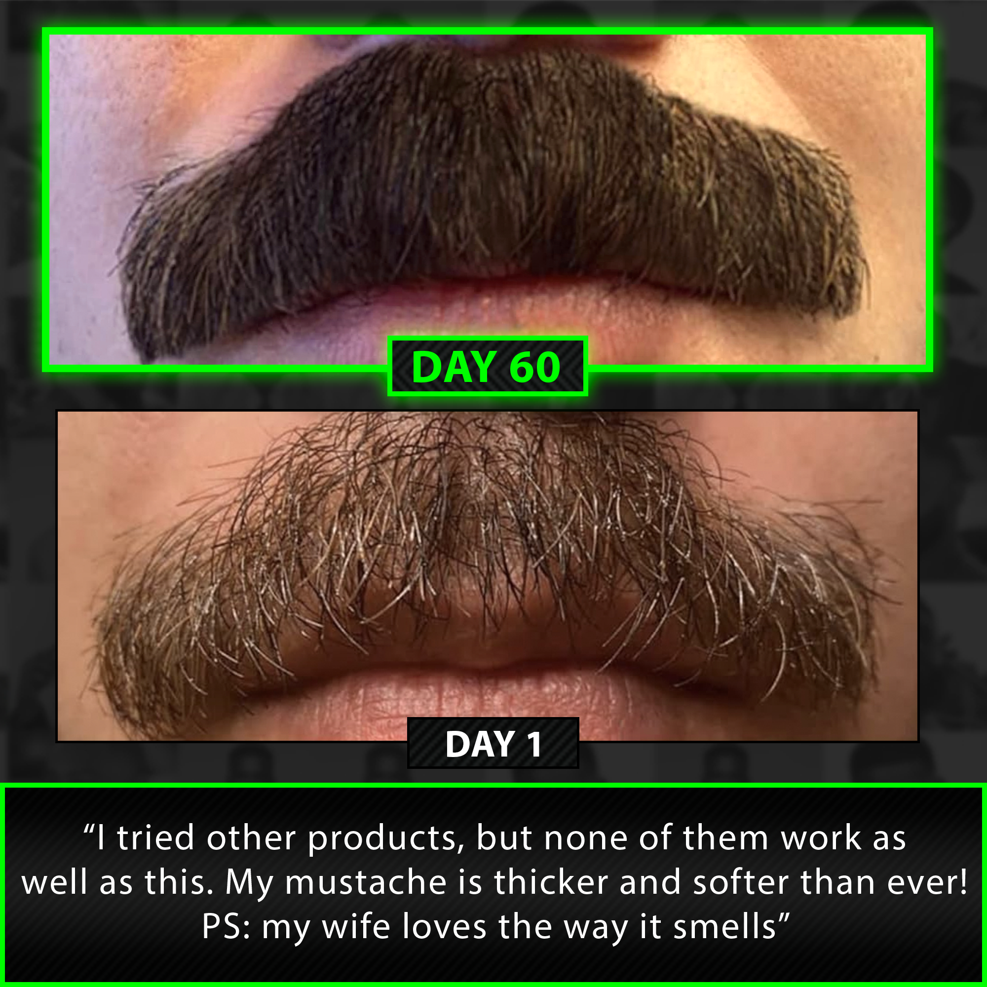 Perfect Beard Growth Kit